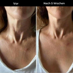 Hudteori Retinol Kropslotion