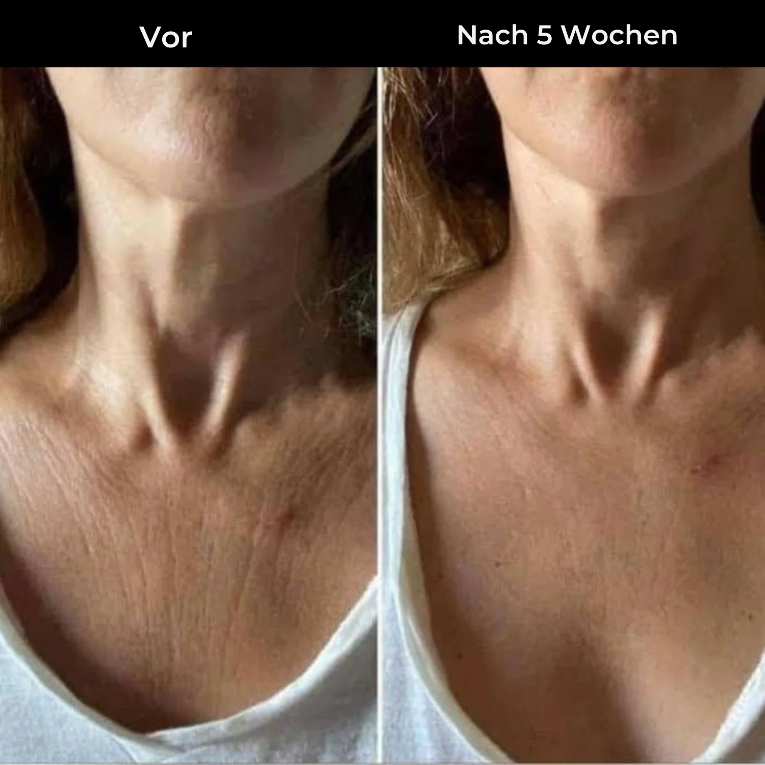 Hudteori Retinol Kropslotion