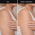 Hudteori Retinol Kropslotion