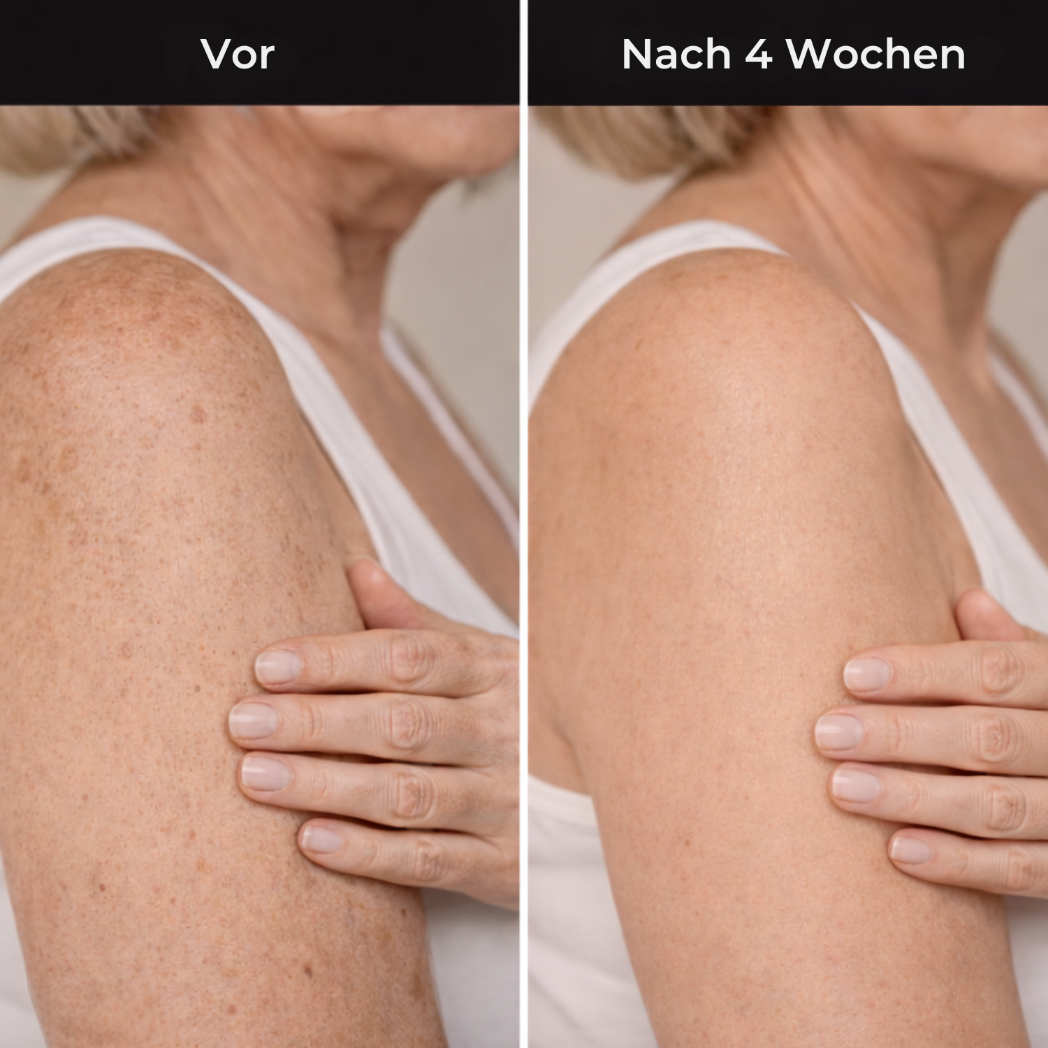 Hudteori Retinol Kropslotion