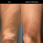 Hudteori Retinol Kropslotion