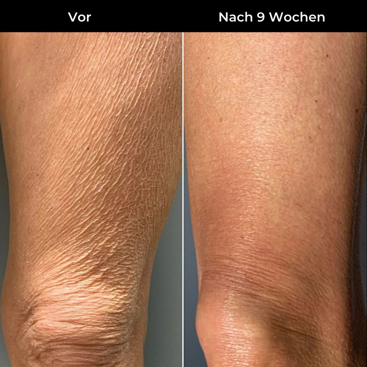 Hudteori Retinol Kropslotion