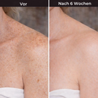 Hudteori Retinol Kropslotion