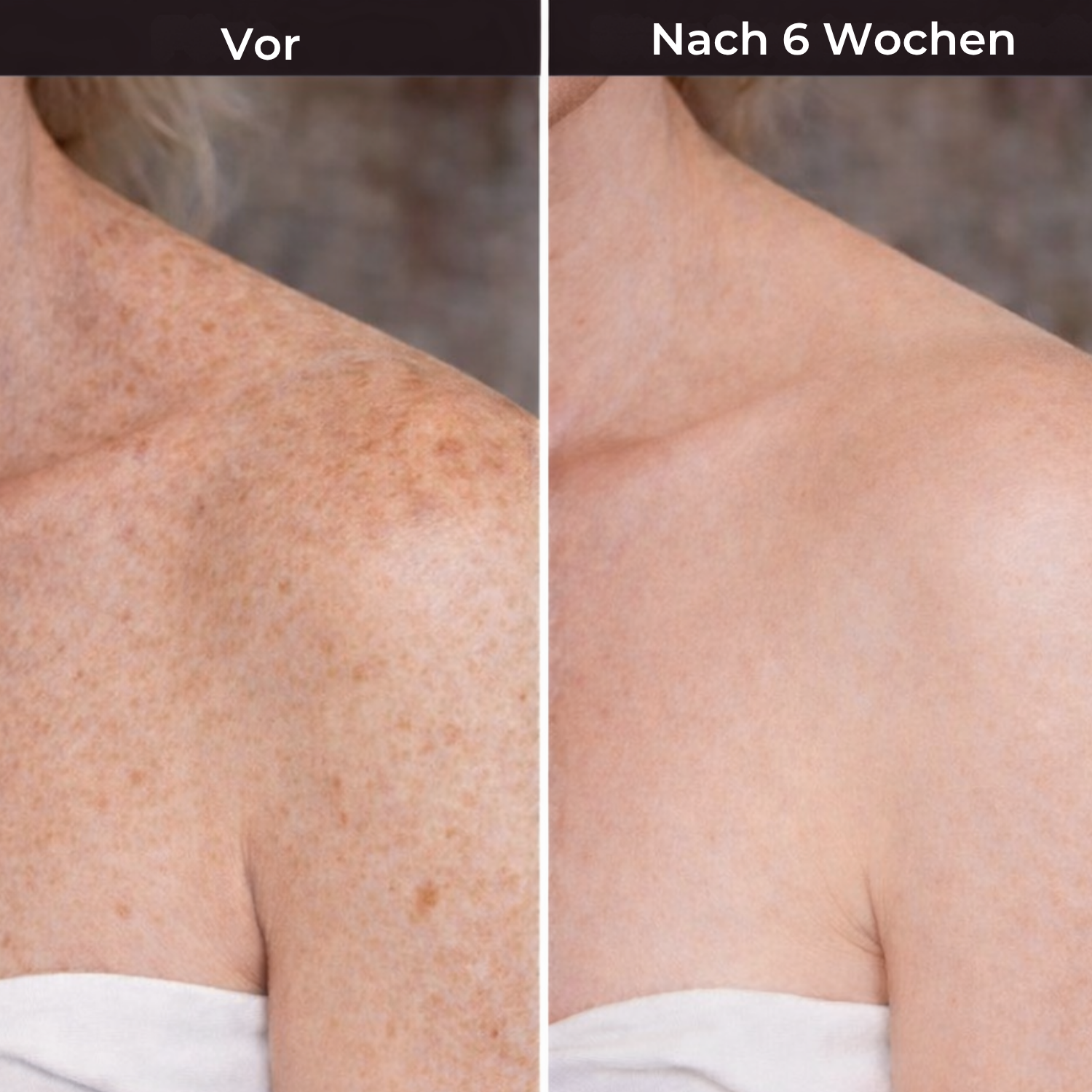 Hudteori Retinol Kropslotion