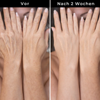 Hudteori Retinol Kropslotion