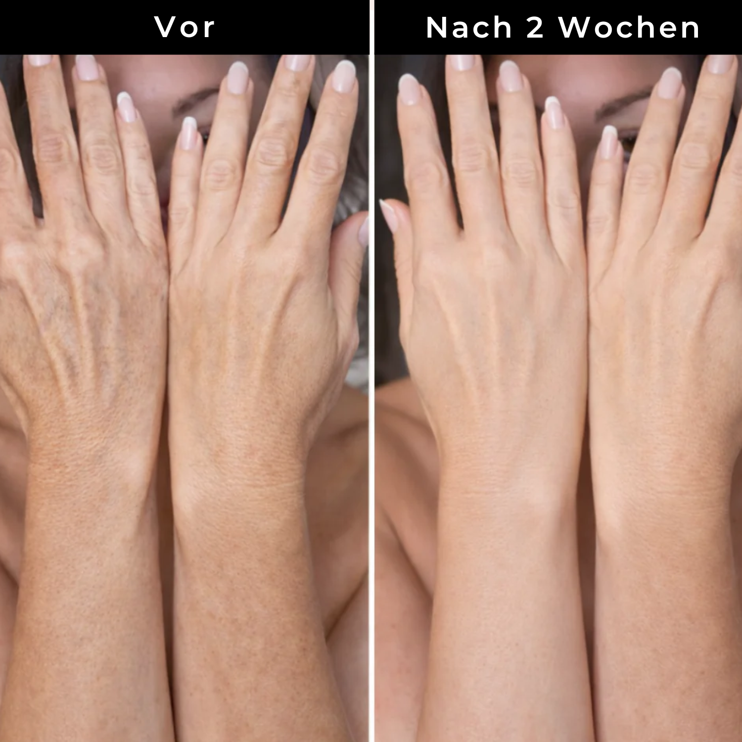 Hudteori Retinol Kropslotion