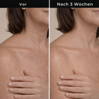 Hudteori Retinol Kropslotion