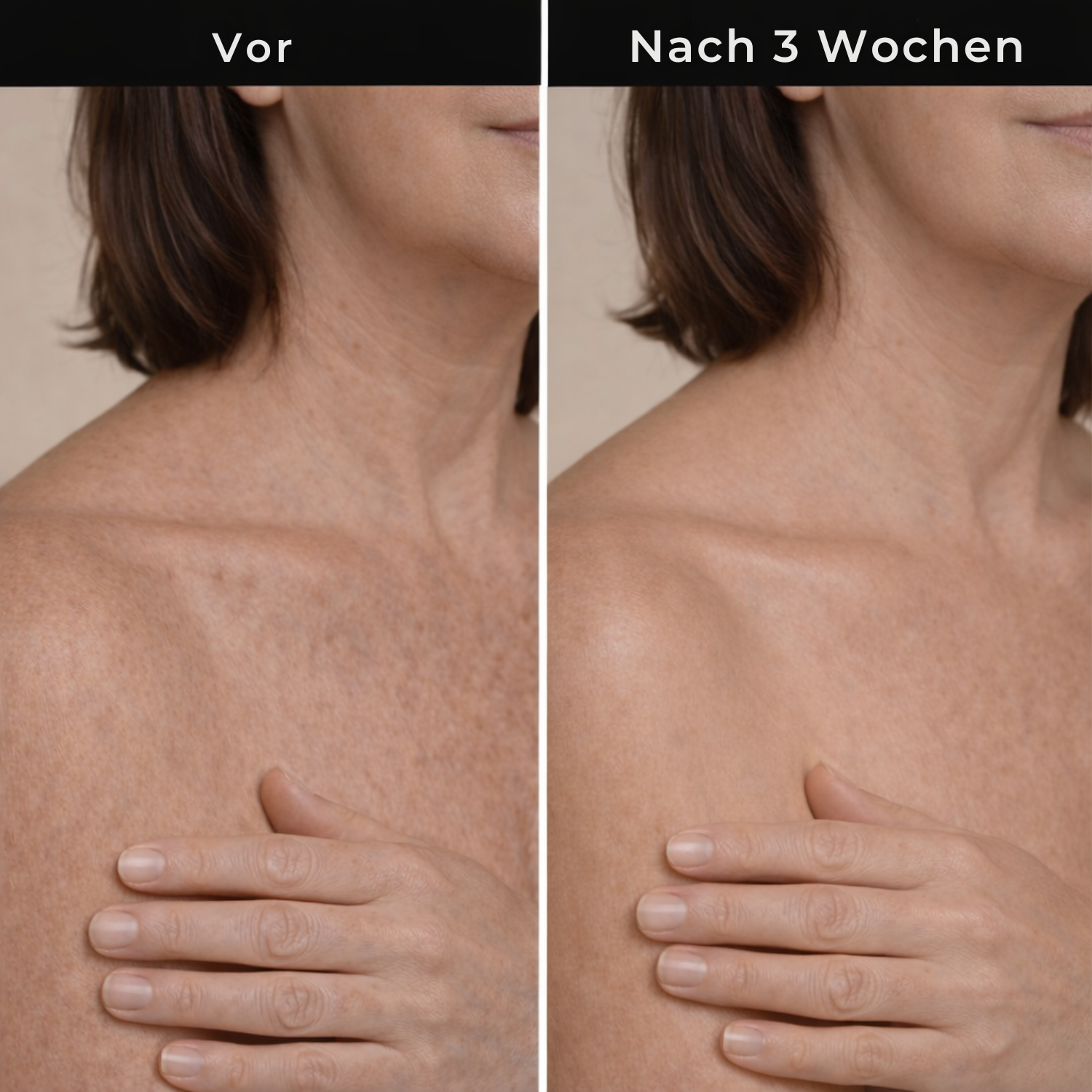 Hudteori Retinol Kropslotion